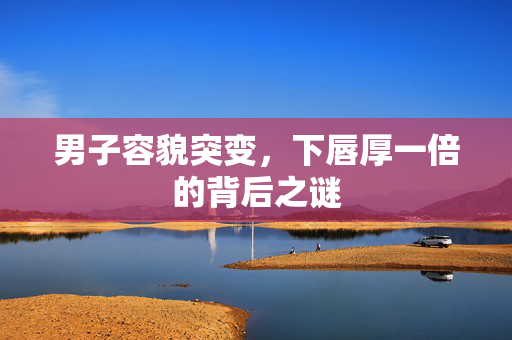 男子容貌突变，下唇厚一倍的背后之谜